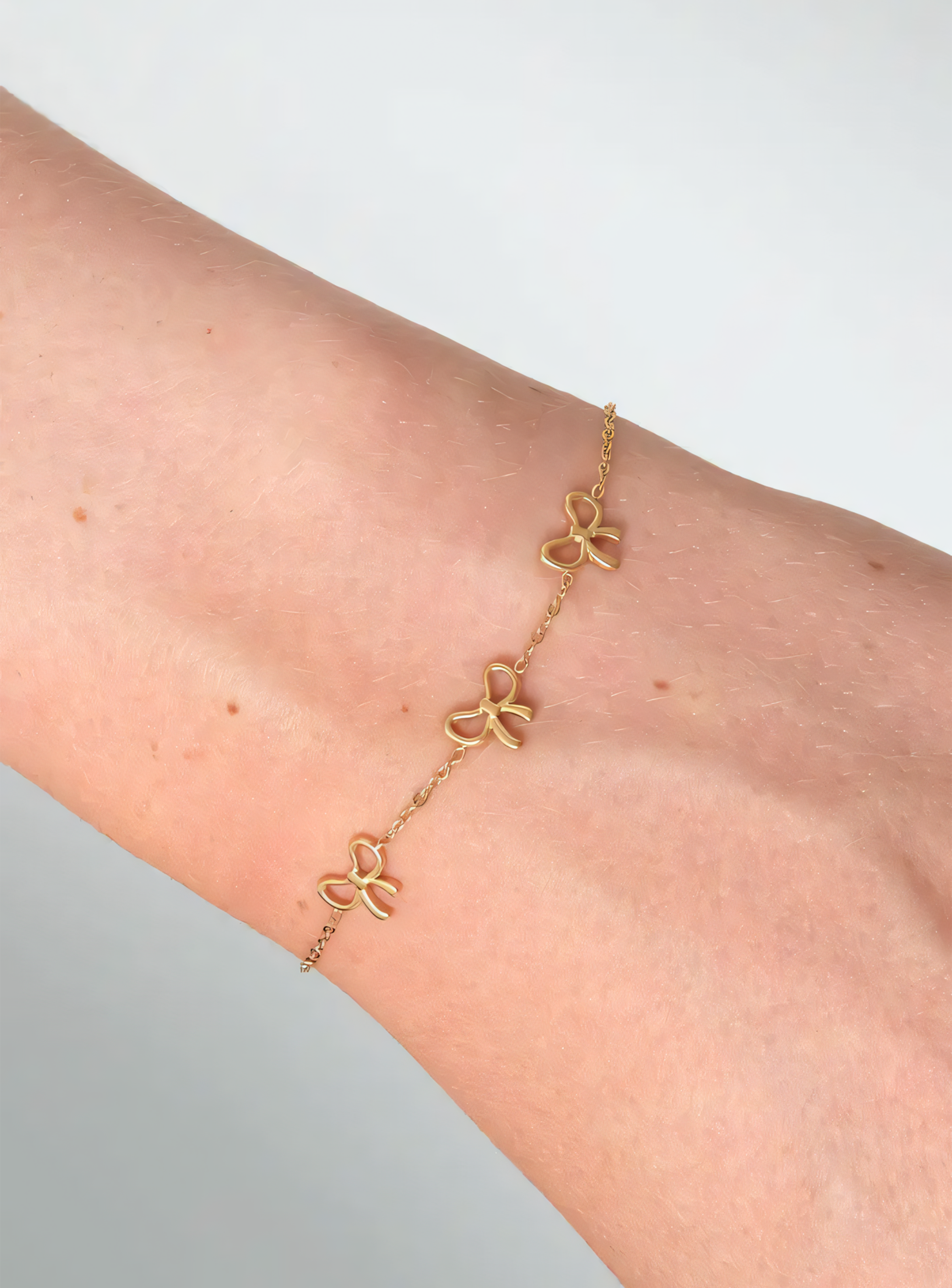 Phlia Armband